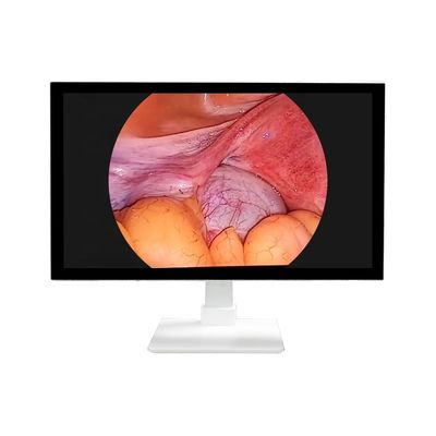 購入 クラスI 4K 32' オールインワン 硬い医療ビデオ エンドスコピー LED 光源 ラパラスコピー システム エンドスコップ カメラ オンライン製造