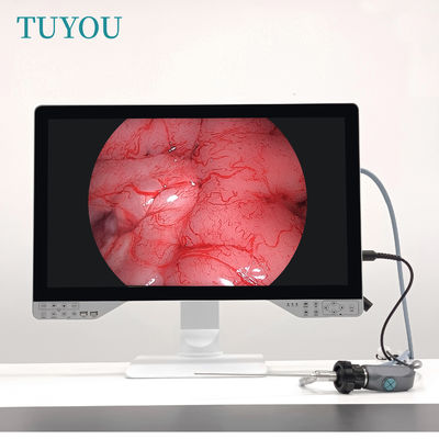 購入 TUYOU 27インチ 1080P フルHD オールインワン医療用内視鏡カメラ（関節鏡用） オンライン製造