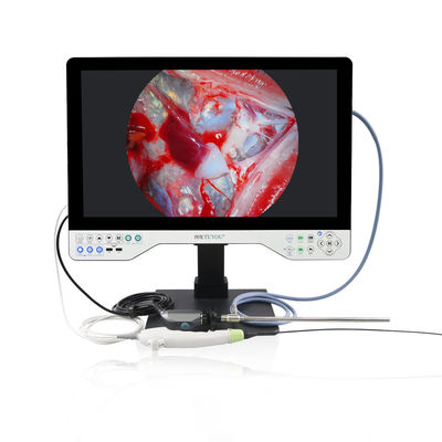 購入 TUYOU メディカル 1080P 24' 硬くて柔軟な オールインワン エンドスコップ カメラシステム ウロスコピー手術に最適 防水 オンライン製造