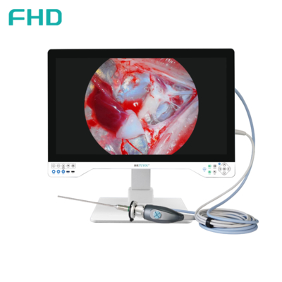 購入 TUYOU オールインワン FHD 内視鏡カメラシステム、32インチ手術用モニター搭載、耳鼻咽喉科および泌尿器科手術用 オンライン製造