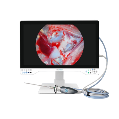 購入 32-inch 4K Medical Endoscope Camera with 8-Hour Battery Life オンライン製造