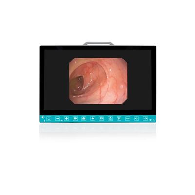 購入 TUYOU 13.3-Inch FHD Flexible Endoscope Camera System Multi-Color OEM Custom All-in-One Portable Uro-Gyn TikTok Hit オンライン製造