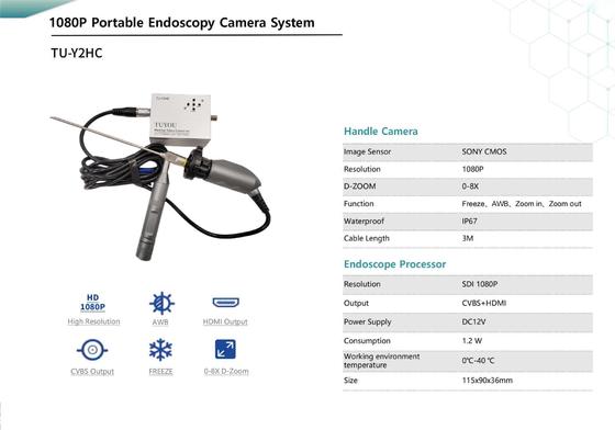 購入 TUYOU TU-Y2HC FHD Portable Medical Endoscope Camera with HDMI/CVBS FOR ENT,0-8X D-Zoom オンライン製造