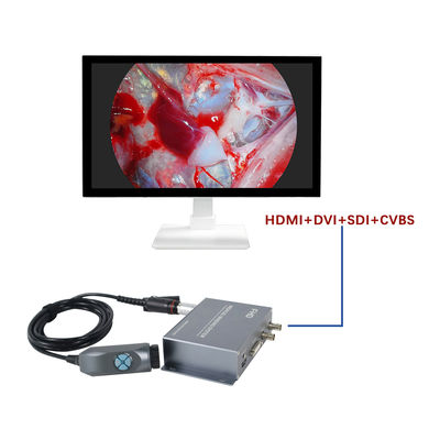 購入 TUYOU Manufacturer4-Output FHD Portable  Endoscopy Camera System  For ENT Checking オンライン製造