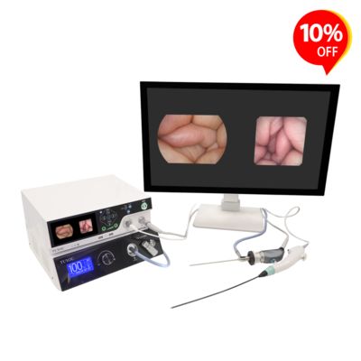 購入 TUYOU HD Endoscopy Camera System with ENT Bronchoscopy Checking and Laparoscopy Urology Applications Featuring Auto White Balance オンライン製造