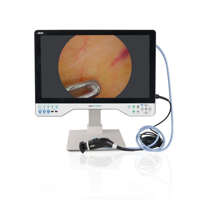 購入 Manufacturer Direct 24 Inches 1080P All-in-one Camera System For Laparoscopy Surgery ENT Checking オンライン製造