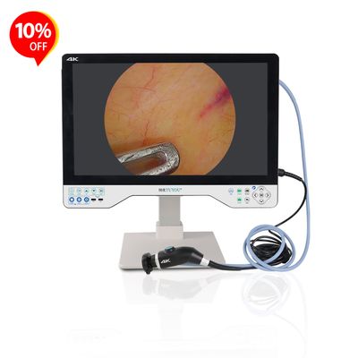 購入 All-in-one Camera System With 24 Inches Monitor For Laparoscopy ENT Surgery Manufacturer  オンライン製造