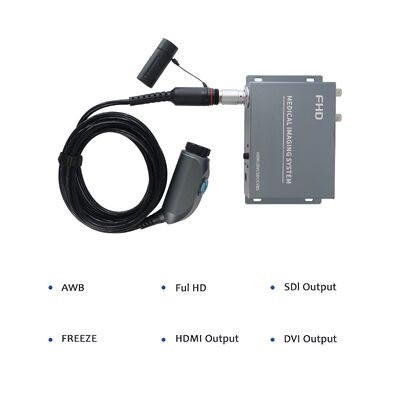 購入 Wireless Portable Endoscope Camera System - High Resolution for ENT/Orthopedics Clinical Examination オンライン製造