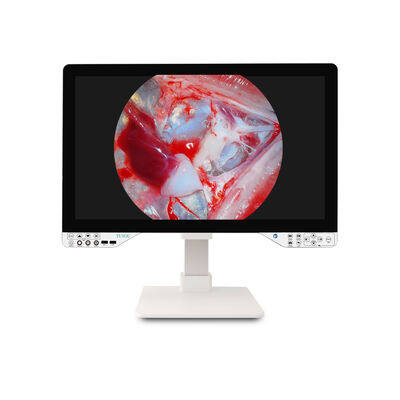 購入 メディカルグレード TUYOU 27インチ オールインワン内視カメラ - Laparoscopic ENT 手術のためのFHD/4K オンライン製造