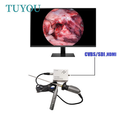 フルHD 電動 携帯型 ENT エンドスコップ ラップトップ コンピュータ 医療 カメラ