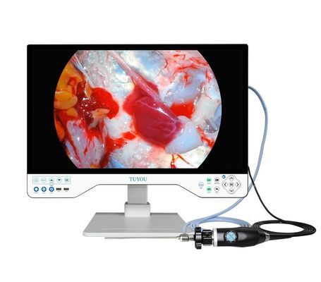 ポータブルHD内視鏡カメラと光源のオールインワンECTカメラシステム