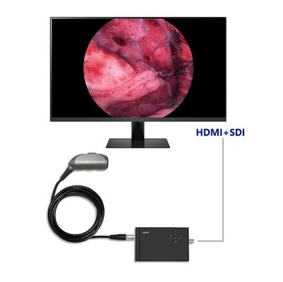 TUYOUポータブル内視鏡ビデオカメラ フルHD 1920×1080 解像度 120 度 泌尿器脊髄とECT手術のための視野