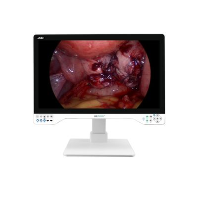 プロフェッショナル メーカー 4K 32インチ エンドスコピー カメラ ラパロスコピー システム用の光源を統合